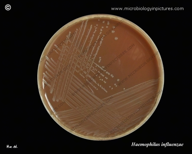 Haemophilus influenzae on chocolate agar plate haemophilus influenzae